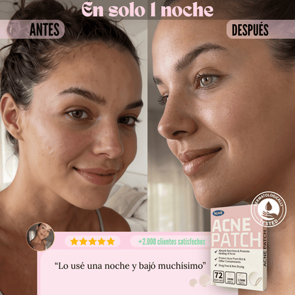 Nuvie™ Clear Patches